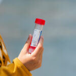 Microplastics in Human Blood